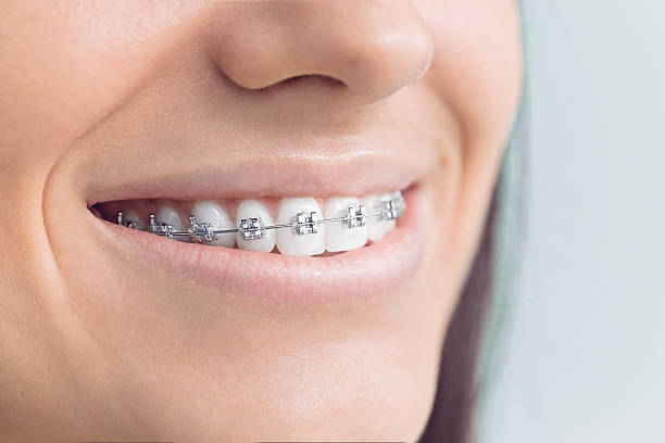 Why Choose Us for Your Dental Needs in Big Sky, MT